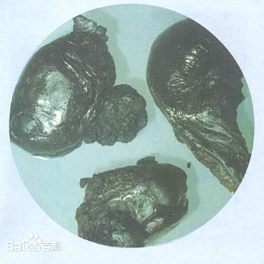 鸦片的医用历史：从神坛到争议