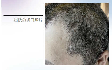 失效罗盘与神秘北极石质头骨|一场跨越时空的谜题 失效罗盘与神秘北极石质头骨|一场跨越时空的谜题