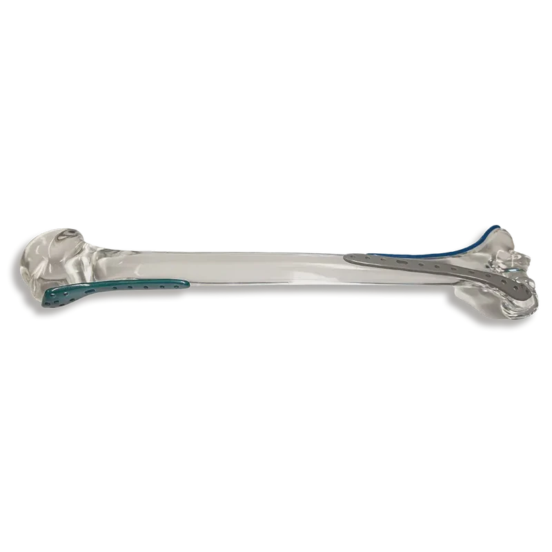 阿拉伯海外植入物的隐秘战场！