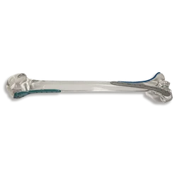 阿拉伯海外植入物的隐秘战场！