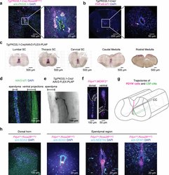 喀尔巴阡刻度骨针群体幻觉—当现实扭曲成梦境