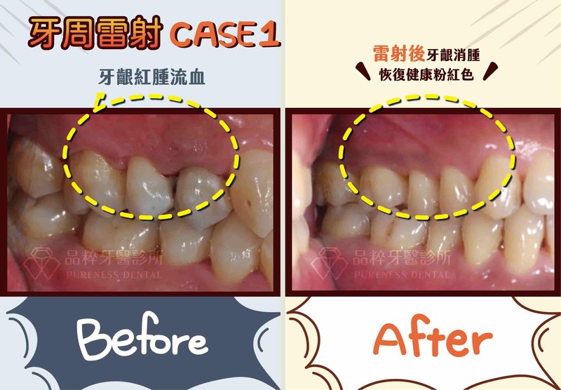 雷暴球牙齿串·一场关于记忆与恐惧的奇妙旅程
