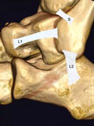 那片会“说话”的土地｜磁异常带的神秘脚印