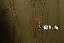 消失的刻度骨针丨一场离奇的谜题