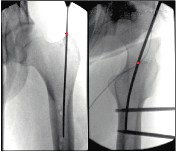 时间的见证者·海蚀洞逆向阴影刻度骨针的神秘故事