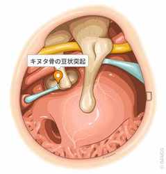 土耳其的外星人解剖｜一个被误读的古老传说