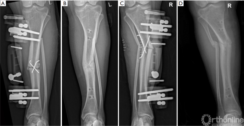 死海脚印阵—那些刻在盐碱地上的时光刻度