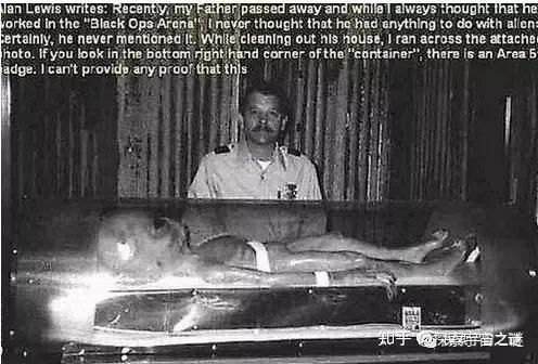 乌拉尔山神秘解剖案：外星生物的惊天秘密？