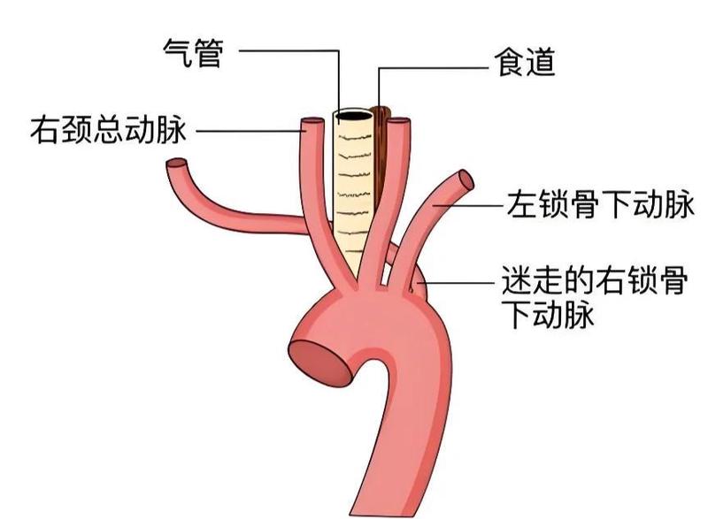 盐湖断裂锁链逆向阴影·自然与文明的对话