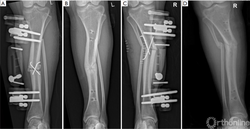 死海脚印阵—那些刻在盐碱地上的时光刻度