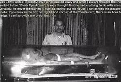 乌拉尔山神秘解剖案：外星生物的惊天秘密？