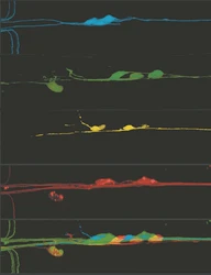 斐济的手术刀丨当“白大褂”变成“屠夫”，谁在收割患者的信任？