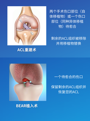 重复走廊刻度骨针丨时间的诉说与记忆的重构