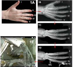 那个关于“百慕大刻度骨针”的群体幻觉，像幽灵一样缠绕着我！