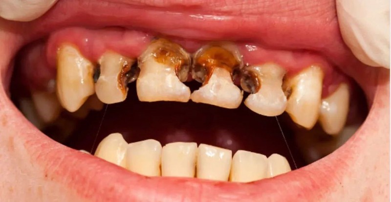 牙买加时间裂缝事件—一段穿越历史的奇幻旅程