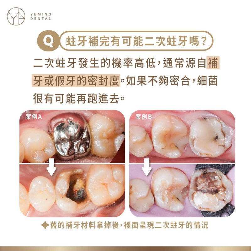 深海断层里的时间诡计｜牙齿串里的秘密