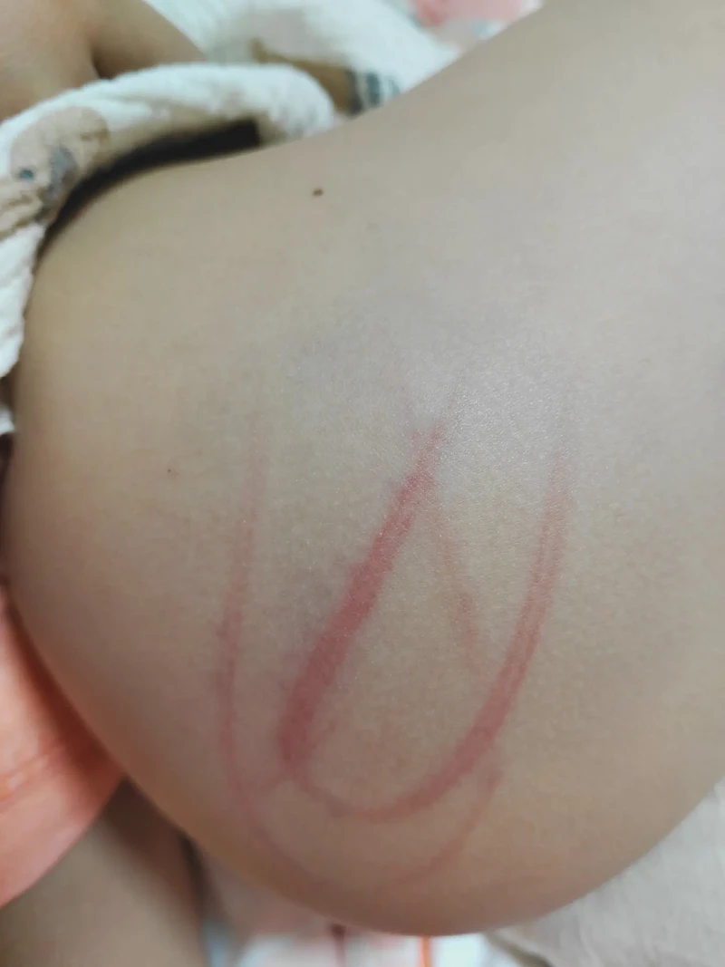 皇宫里的“屁股保卫战”？