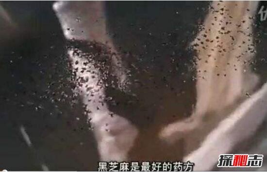 用牙签挑出过程令人头皮发麻-惊悚！女孩毛孔嵌入芝麻粒 (用牙签挑出过的虫子)(图1)